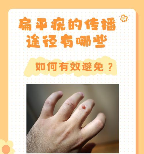 人类疾病传染（传染病的爆发和预防措施）(图2)