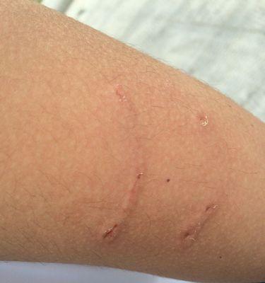 雪纳瑞狗狗狂犬疫苗接种时间解析（了解雪纳瑞狗狗的疫苗接种计划，守护它的健康）(图2)