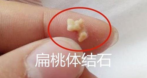 身上气味臭可能是什么病？（探索身体气味异常的潜在疾病及其治疗方法）(图1)