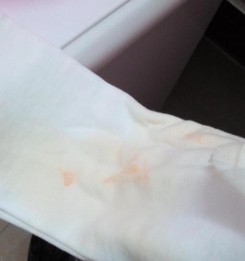 尿中出现血迹，你需要了解的原因和应对方法(图3)