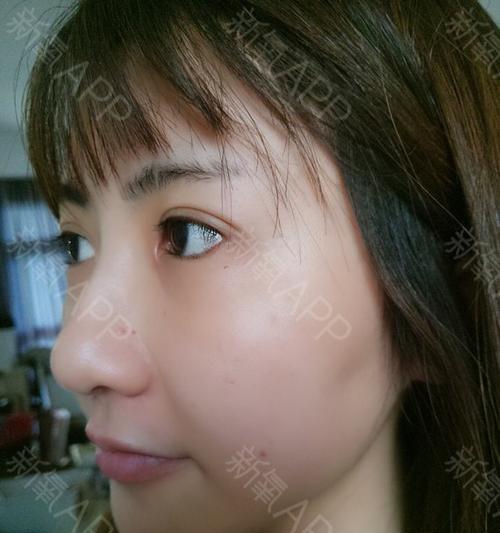 怀孕64天的症状及应对措施（了解怀孕初期的身体变化，做好孕期 - 新生家伴