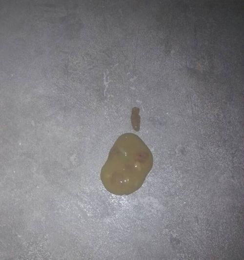 犬蛔虫引发的拉稀问题——从原因到预防（详解犬蛔虫感染对狗狗拉稀的影响与防治方法）(图3)