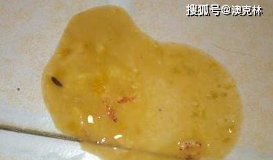 狗罐装病毒（了解病毒传播途径和常见症状，提高防控意识）(图3)