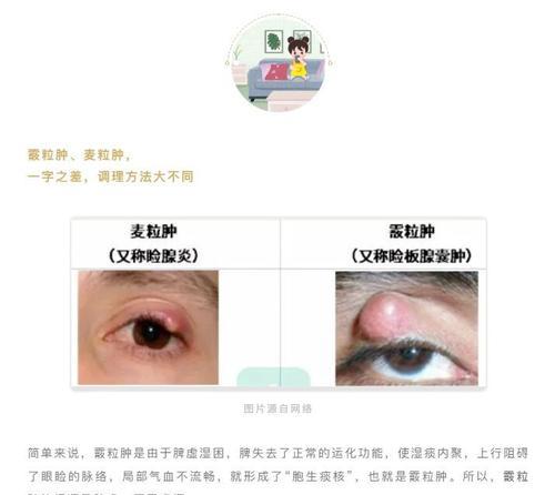 眼屎的颜色代表什么？（揭秘眼屎颜色与健康的关系）(图2)