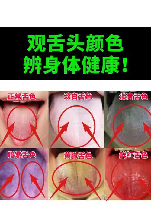 舌苔颜色的意义及影响（舌苔颜色的正常范围及可能的健康问题）(图3)