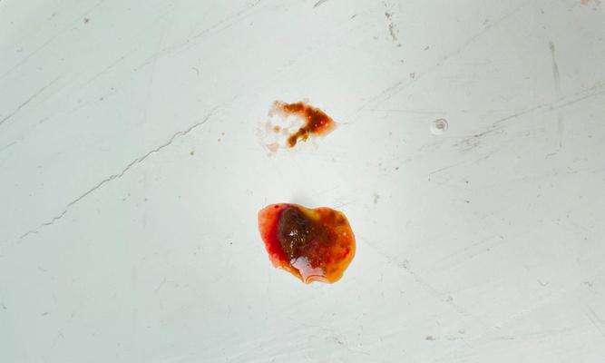 成年狗拉血的原因及处理方法（探究成年狗拉血的可能原因及有效的 - 新生家伴