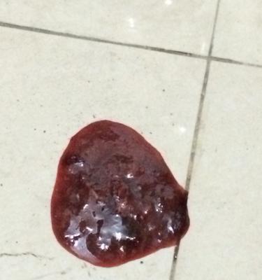 成年狗拉血的原因及处理方法(探究成年狗拉血的可能原因及有效的处理方法)(图3) 成年狗拉血的原因及处理方法(探究成年狗拉血的可能原因及有效的处理方法)(图3)