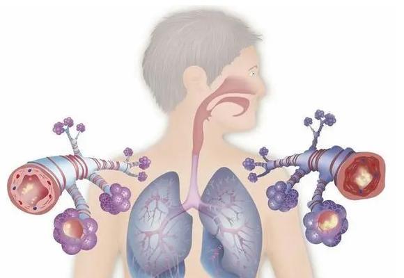 比熊气管炎——常见症状及治疗方法(了解比熊气管炎,保护我们的爱宠)(图2) 比熊气管炎——常见症状及治疗方法(了解比熊气管炎,保护我们的爱宠)(图2)