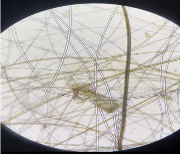 克维舒抗菌病例 | 一例犬跳蚤叮咬性皮炎（FAD）的病例分析(图6)