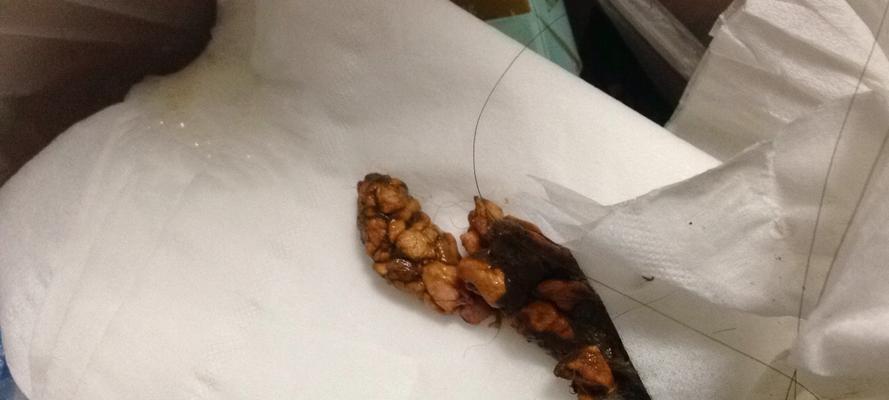 细小早期拉什么便便？（细小早期拉什么便便，了解症状与治疗方法）(图1)