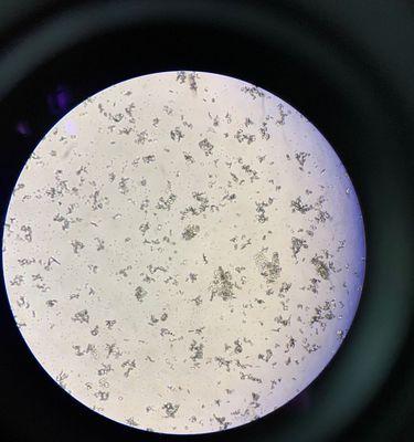 膀胱结晶（了解膀胱结晶的形成原因，识别其症状，并探讨相关治疗方法）(图3)