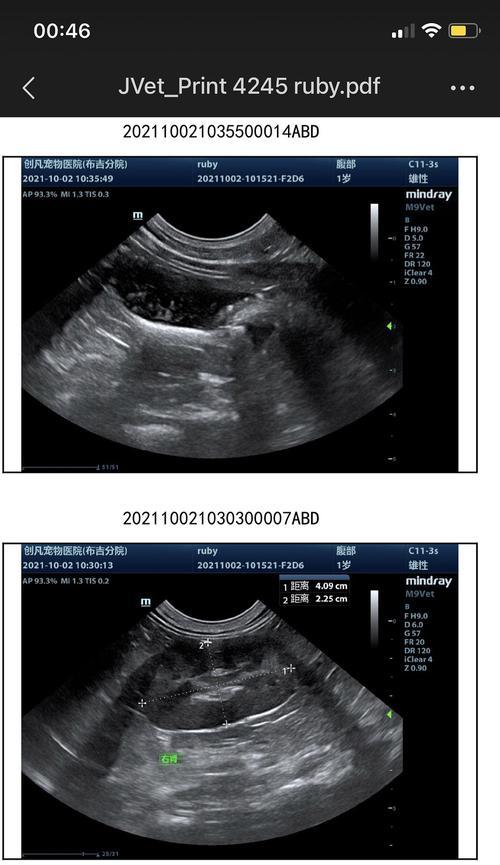 膀胱结晶（了解膀胱结晶的形成原因，识别其症状，并探讨相关治疗方法） - 新生家伴