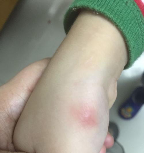 猫猫弓虫病（预防和治疗猫猫弓虫病的重要知识，让你的猫咪远离健康威胁） - 新生家伴