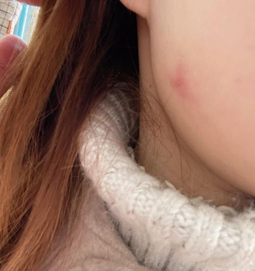 猫咪身上的细菌(探索猫咪身上的常见细菌,保护你和你的宠物的健康)(图1) 猫咪身上的细菌(探索猫咪身上的常见细菌,保护你和你的宠物的健康)(图1)