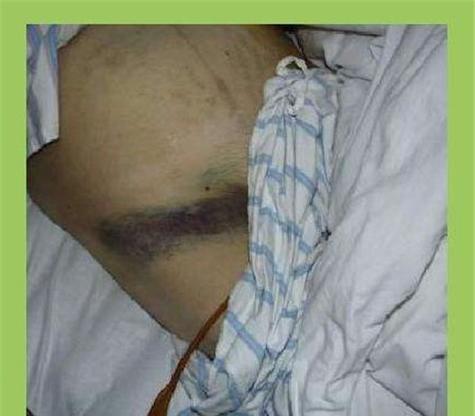 胰头炎的症状(胰头炎的症状是什么?如何预防和治疗?)(图2) 胰头炎的症状(胰头炎的症状是什么?如何预防和治疗?)(图2)