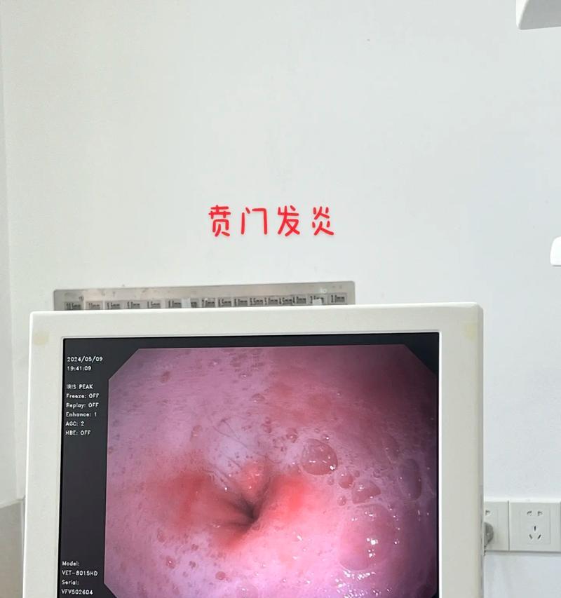 呕吐黄水的原因及应对方法（了解呕吐黄水的病因，保护身体健康）(图2)