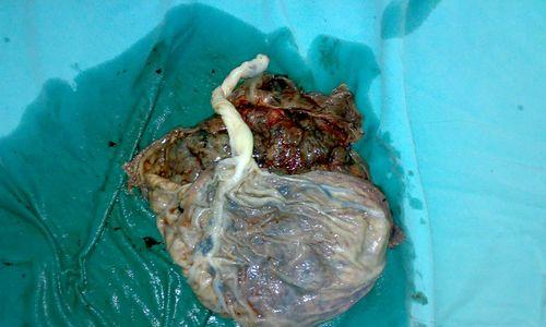 狗的胎盘（探索狗的胎盘结构、功能与重要性）(图3)