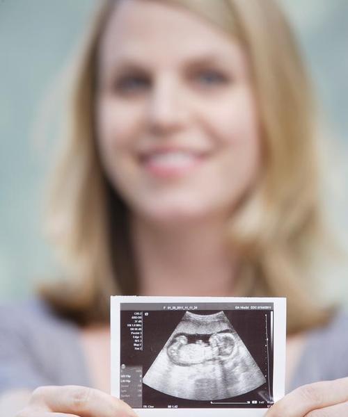 猫咪怀孕多久开始增加食量？（猫咪的食量随孕期变化，关键是确保营养均衡）(图2)