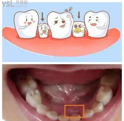 大牙的更替时机和保健方法（了解大牙更替的