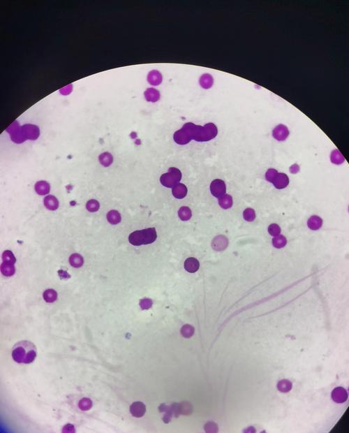 以犬焦虫——狗狗健康的威胁（以犬焦虫的症状及预防措施） - 新生家伴