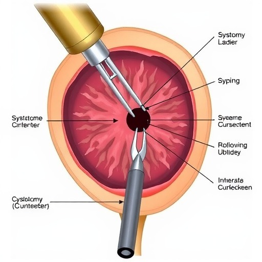 8张图带你解锁新技能——膀胱切开术（附手术视频）(图5)