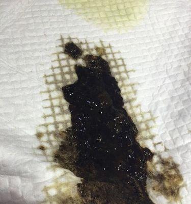 揭秘狗狗舌头三点黑色的原因（探究狗狗舌头黑点的成因与对健康的影响）(图2)