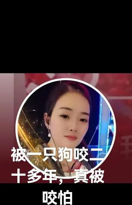 为什么我家狗总是被咬？（探究背后的原因以及如何保护我们的宠物）(图2)