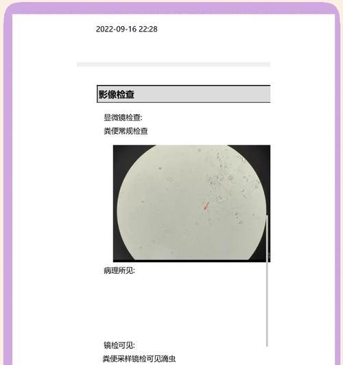 猫咪粪便常规检查的重要性（了解猫咪健康状况的窗口，常规检查粪便）(图3)