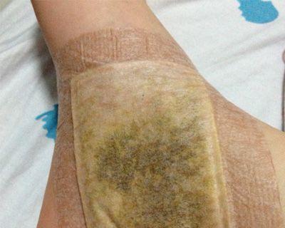 贵宾扭伤脚的康复时间及护理要点（探索贵宾扭伤脚康复的关键步骤与时间安排）(图2)