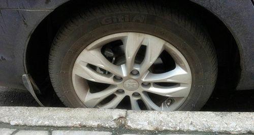 车祸后的内伤（探究车祸后内伤的潜伏期及其影响因素）(图2)